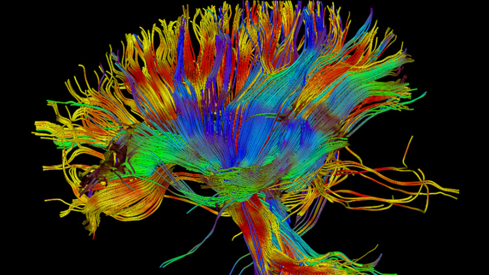 FMRI Brain Image dti - mri